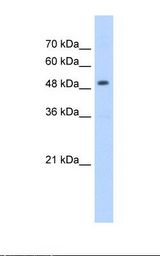 HMGCS2 / HMG-CoA Synthase 2 Antibody - Jurkat cell lysate. Antibody concentration: 5.0 ug/ml. Gel concentration: 12%.  This image was taken for the unconjugated form of this product. Other forms have not been tested.