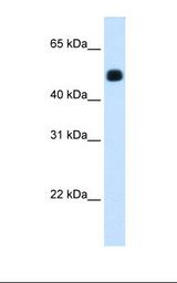 HMGCS2 / HMG-CoA Synthase 2 Antibody - Fetal liver cell lysate. Antibody concentration: 1.25 ug/ml. Gel concentration: 12%.  This image was taken for the unconjugated form of this product. Other forms have not been tested.