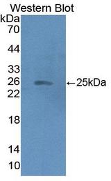 HMGCS2 / HMG-CoA Synthase 2 Antibody - Western Blot; Sample: Recombinant protein.