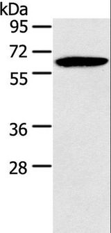 HMGCS2 / HMG-CoA Synthase 2 Antibody - Western blot analysis of Mouse brain tissue, using HMGCS2 Polyclonal Antibody at dilution of 1:200.