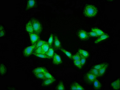 HMGCS2 / HMG-CoA Synthase 2 Antibody - Immunofluorescence staining of HepG2 cells at a dilution of 1:133, counter-stained with DAPI. The cells were fixed in 4% formaldehyde, permeabilized using 0.2% Triton X-100 and blocked in 10% normal Goat Serum. The cells were then incubated with the antibody overnight at 4°C.The secondary antibody was Alexa Fluor 488-congugated AffiniPure Goat Anti-Rabbit IgG (H+L) .