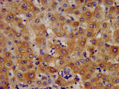 HMGCS2 / HMG-CoA Synthase 2 Antibody - Immunohistochemistry image at a dilution of 1:400 and staining in paraffin-embedded human liver tissue performed on a Leica BondTM system. After dewaxing and hydration, antigen retrieval was mediated by high pressure in a citrate buffer (pH 6.0) . Section was blocked with 10% normal goat serum 30min at RT. Then primary antibody (1% BSA) was incubated at 4 °C overnight. The primary is detected by a biotinylated secondary antibody and visualized using an HRP conjugated SP system.