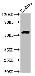 HMGCS2 / HMG-CoA Synthase 2 Antibody - Positive Western Blot detected in Rat kidney tissue. All lanes: HMGCS2 antibody at 4.5 µg/ml Secondary Goat polyclonal to rabbit IgG at 1/50000 dilution. Predicted band size: 57, 53, 51 KDa. Observed band size: 57 KDa
