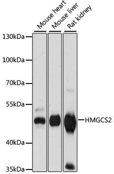 HMGCS2 / HMG-CoA Synthase 2 Antibody - Western blot analysis of extracts of various cell lines, using HMGCS2 antibody at 1:1000 dilution. The secondary antibody used was an HRP Goat Anti-Rabbit IgG (H+L) at 1:10000 dilution. Lysates were loaded 25ug per lane and 3% nonfat dry milk in TBST was used for blocking. An ECL Kit was used for detection and the exposure time was 30s.