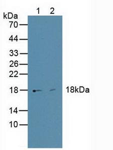 HMGIY / HMGA1 Antibody - Western Blot; Sample: Lane1: Human HepG2 Cells; Lane2: Human BXPC-3 Cells.