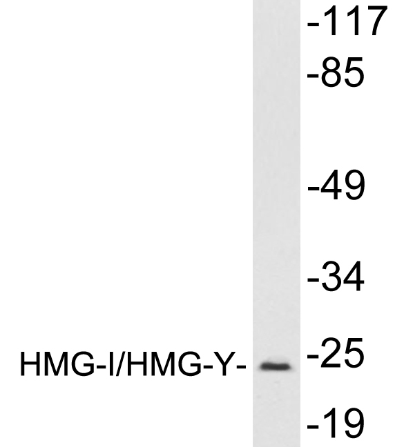 HMGIY / HMGA1 Antibody - Western blot analysis of lysates from mouse brain tissue, using HMG-I/HMG-Y antibody.