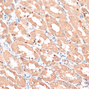 HMGIY / HMGA1 Antibody - Immunohistochemistry of paraffin-embedded human stomach using HMGA1 antibody at dilution of 1:100 (40x lens).
