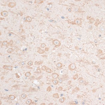 HMGIY / HMGA1 Antibody - Immunohistochemistry of paraffin-embedded mouse brain using HMGA1 antibody at dilution of 1:100 (40x lens).