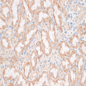 HMGIY / HMGA1 Antibody - Immunohistochemistry of paraffin-embedded mouse kidney using HMGA1 antibody at dilution of 1:100 (40x lens).