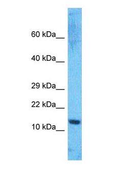 HMGIY / HMGA1 Antibody - Western blot of HMGA1 Antibody with human Jurkat Whole Cell lysate.  This image was taken for the unconjugated form of this product. Other forms have not been tested.