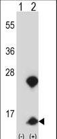 HMGN1 / HMG14 Antibody - Western blot of HMGN1 (arrow) using rabbit polyclonal HMGN1 Antibody. 293 cell lysates (2 ug/lane) either nontransfected (Lane 1) or transiently transfected (Lane 2) with the HMGN1 gene.