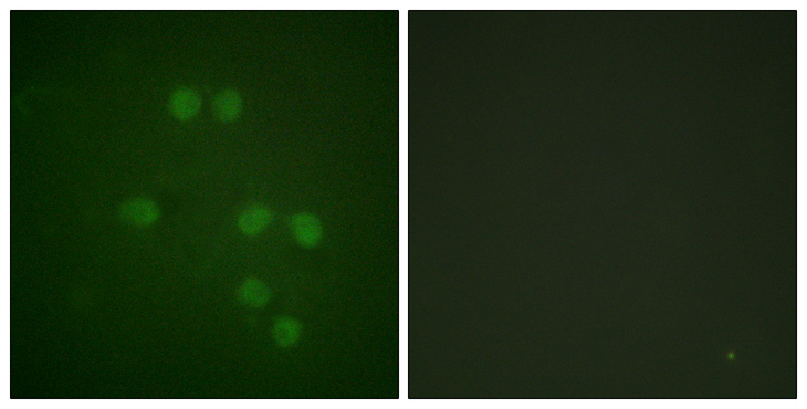 HMGN1 / HMG14 Antibody - Immunofluorescence analysis of HepG2 cells, using HMG14 Antibody. The picture on the right is blocked with the synthesized peptide.