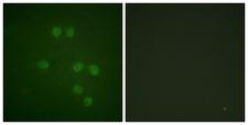 HMGN1 / HMG14 Antibody - Immunofluorescence analysis of HepG2 cells, using HMG14 Antibody. The picture on the right is blocked with the synthesized peptide.