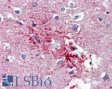 HMGN1 / HMG14 Antibody - Anti-HMGN1 antibody IHC of human brain, cortex, senile plaque. Immunohistochemistry of formalin-fixed, paraffin-embedded tissue after heat-induced antigen retrieval. Antibody concentration 5 ug/ml.  This image was taken for the unconjugated form of this product. Other forms have not been tested.