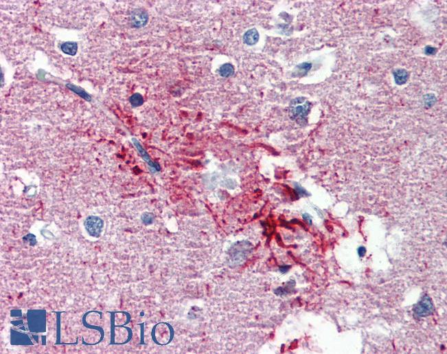 HMGN1 / HMG14 Antibody - Anti-HMGN1 antibody IHC of human brain, cortex, senile plaque. Immunohistochemistry of formalin-fixed, paraffin-embedded tissue after heat-induced antigen retrieval. Antibody concentration 5 ug/ml.  This image was taken for the unconjugated form of this product. Other forms have not been tested.