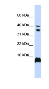 HMGN1 / HMG14 Antibody - HMGN1 antibody Western blot of 721_B cell lysate. This image was taken for the unconjugated form of this product. Other forms have not been tested.