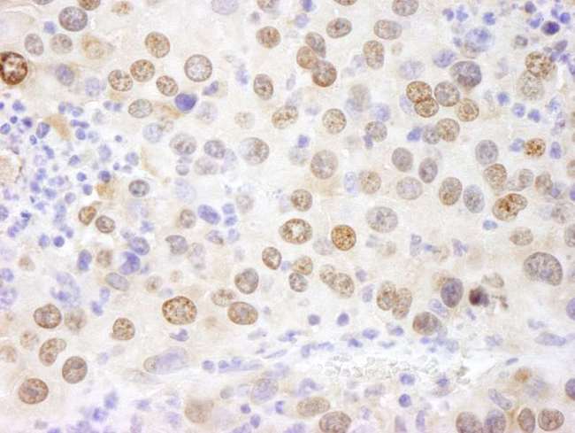 HMGN1 / HMG14 Antibody - Detection of Mouse HMGN1 by Immunohistochemistry. Sample: FFPE section of mouse renal cell carcinoma. Antibody: Affinity purified rabbit anti-HMGN1 used at a dilution of 1:250.