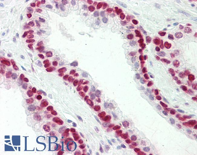 HMGN1 / HMG14 Antibody - Anti-HMGN1 antibody IHC staining of human prostate. Immunohistochemistry of formalin-fixed, paraffin-embedded tissue after heat-induced antigen retrieval. Antibody concentration 5 ug/ml.  This image was taken for the unconjugated form of this product. Other forms have not been tested.