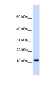 HMGN1 / HMG14 Antibody - HMGN1 antibody Western blot of Fetal Heart lysate.  This image was taken for the unconjugated form of this product. Other forms have not been tested.