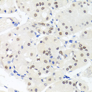 HMGN1 / HMG14 Antibody - Immunohistochemistry of paraffin-embedded human stomach tissue.