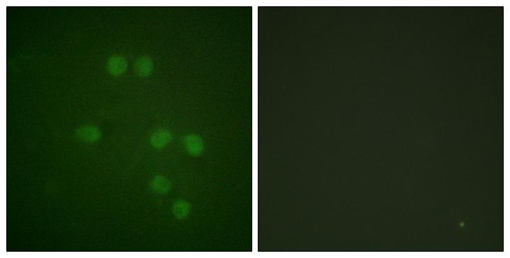 HMGN1 / HMG14 Antibody - Peptide - + Immunofluorescence analysis of HepG2 cells, using HMG14 antibody.