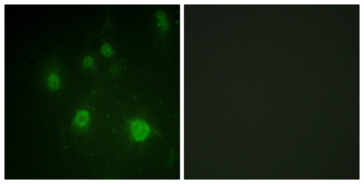 HMGN1 / HMG14 Antibody - Immunofluorescence analysis of COS7 cells, using HMG14 (Phospho-Ser21) Antibody. The picture on the right is blocked with the phospho peptide.