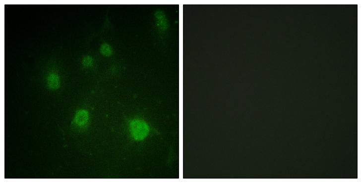 HMGN1 / HMG14 Antibody - P-peptide - + Immunofluorescence analysis of COS7 cells, using HMG14 (Phospho-Ser21) antibody.