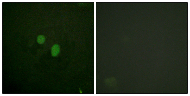 HMGN2 Antibody - Immunofluorescence analysis of HeLa cells, using HMG17 Antibody. The picture on the right is blocked with the synthesized peptide.