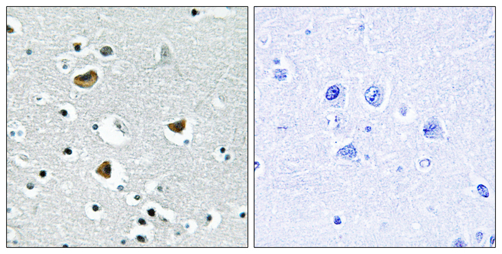 HMGN2 Antibody - Immunohistochemistry analysis of paraffin-embedded human brain tissue, using HMG17 Antibody. The picture on the right is blocked with the synthesized peptide.