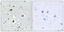HMGN2 Antibody - Immunohistochemistry analysis of paraffin-embedded human brain tissue, using HMG17 Antibody. The picture on the right is blocked with the synthesized peptide.