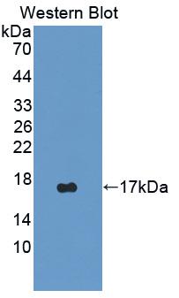 HMGN2 Antibody - Western blot of HMGN2 antibody.