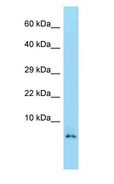 HMGN2 Antibody - HMGN2 antibody Western Blot of Mouse Spleen.  This image was taken for the unconjugated form of this product. Other forms have not been tested.