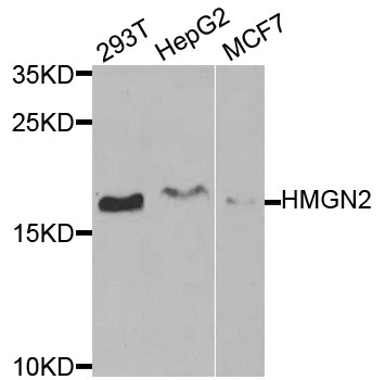 HMGN2 Antibody - Western blot analysis of extracts of various cells.