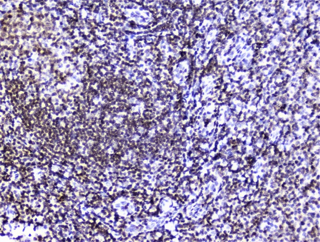 HMGN2 Antibody - IHC analysis of HMGN2 using anti-HMGN2 antibody. HMGN2 was detected in paraffin-embedded section of human tonsil tissue. Heat mediated antigen retrieval was performed in citrate buffer (pH6, epitope retrieval solution) for 20 mins. The tissue section was blocked with 10% goat serum. The tissue section was then incubated with 2µg/ml rabbit anti-HMGN2 Antibody overnight at 4°C. Biotinylated goat anti-rabbit IgG was used as secondary antibody and incubated for 30 minutes at 37°C. The tissue section was developed using Strepavidin-Biotin-Complex (SABC) with DAB as the chromogen.