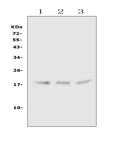 HMGN2 Antibody - Western blot analysis of HMGN2 using anti-HMGN2 antibody. Electrophoresis was performed on a 5-20% SDS-PAGE gel at 70V (Stacking gel) / 90V (Resolving gel) for 2-3 hours. The sample well of each lane was loaded with 50ug of sample under reducing conditions. Lane 1: human Hela whole cell lysate,Lane 2: human A549 whole cell lysate,Lane 3: human U-87MG whole cell lysate. After Electrophoresis, proteins were transferred to a Nitrocellulose membrane at 150mA for 50-90 minutes. Blocked the membrane with 5% Non-fat Milk/ TBS for 1.5 hour at RT. The membrane was incubated with rabbit anti-HMGN2 antigen affinity purified polyclonal antibody at 0.5 µg/mL overnight at 4°C, then washed with TBS-0.1% Tween 3 times with 5 minutes each and probed with a goat anti-rabbit IgG-HRP secondary antibody at a dilution of 1:10000 for 1.5 hour at RT. The signal is developed using an Enhanced Chemiluminescent detection (ECL) kit with Tanon 5200 system. A specific band was detected for HMGN2 at approximately 18KD. The expected band size for HMGN2 is at 18KD.