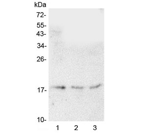 HMGN2 Antibody - Western blot testing of human 1) HeLa, 2) A549 and 3) U-87 MG cell lysate with HMGN2 antibody at 0.5ug/ml. Predicted molecular weight ~18 kDa.