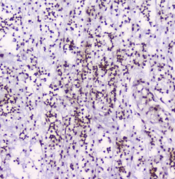 HMGN2 Antibody - IHC staining of FFPE human appendicitis with HMGN2 antibody at 2ug/ml. HIER: boil tissue sections in pH6, 10mM citrate buffer, for 10-20 min followed by cooling at RT for 20 min.