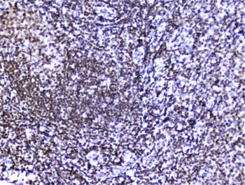 HMGN2 Antibody - IHC staining of FFPE human tonsil tissue with HMGN2 antibody at 2ug/ml. HIER: boil tissue sections in pH6, 10mM citrate buffer, for 10-20 min followed by cooling at RT for 20 min.