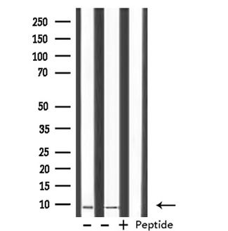 HMGN2 Antibody - Western blot analysis of HMG17 expression in various lysates