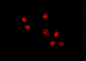 HMGN2 Antibody - Staining HeLa cells by IF/ICC. The samples were fixed with PFA and permeabilized in 0.1% Triton X-100, then blocked in 10% serum for 45 min at 25°C. The primary antibody was diluted at 1:200 and incubated with the sample for 1 hour at 37°C. An Alexa Fluor 594 conjugated goat anti-rabbit IgG (H+L) Ab, diluted at 1/600, was used as the secondary antibody.