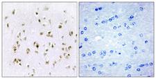 HMGN2 Antibody - Peptide - + Immunohistochemistry analysis of paraffin-embedded human brain tissue, using HMG17 antibody.