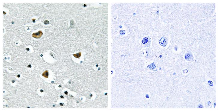 HMGN2 Antibody - Peptide - + Immunohistochemistry analysis of paraffin-embedded human colon carcinoma tissue using HMG17 antibody.