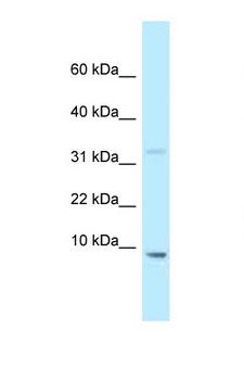 HMGN2 Antibody - HMGN2 antibody Western blot of Mouse Liver lysate. Antibody concentration 1 ug/ml.  This image was taken for the unconjugated form of this product. Other forms have not been tested.