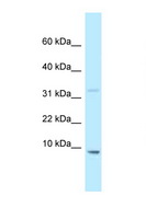HMGN2 Antibody - HMGN2 antibody Western blot of Mouse Liver lysate. Antibody concentration 1 ug/ml.  This image was taken for the unconjugated form of this product. Other forms have not been tested.