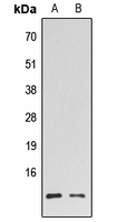 HMGN2 Antibody - Western blot analysis of HMGN2 expression in HL60 (A); K562 (B) whole cell lysates.