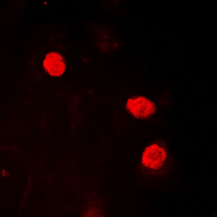 HMGN2 Antibody - Immunofluorescent analysis of HMGN2 staining in HL60 cells. Formalin-fixed cells were permeabilized with 0.1% Triton X-100 in TBS for 5-10 minutes and blocked with 3% BSA-PBS for 30 minutes at room temperature. Cells were probed with the primary antibody in 3% BSA-PBS and incubated overnight at 4 ??C in a humidified chamber. Cells were washed with PBST and incubated with a DyLight 594-conjugated secondary antibody (red) in PBS at room temperature in the dark. DAPI was used to stain the cell nuclei (blue).