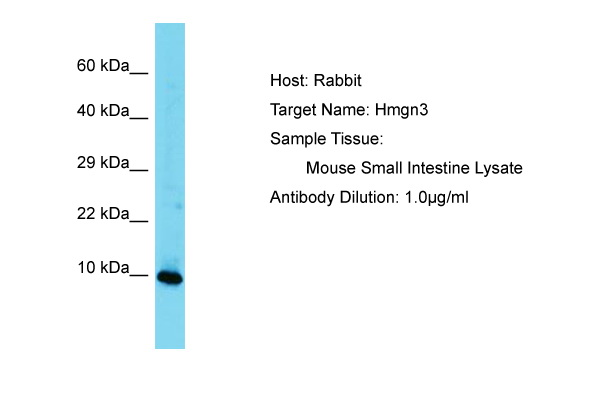 HMGN3 Antibody -  This image was taken for the unconjugated form of this product. Other forms have not been tested.
