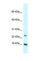 HMGN3 Antibody - HMGN3 antibody Western blot of 721_B Cell lysate. Antibody concentration 1 ug/ml.  This image was taken for the unconjugated form of this product. Other forms have not been tested.