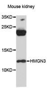 HMGN3 Antibody - Western blot analysis of extracts of mouse kidney, using HMGN3 antibody at 1:3000 dilution. The secondary antibody used was an HRP Goat Anti-Rabbit IgG (H+L) at 1:10000 dilution. Lysates were loaded 25ug per lane and 3% nonfat dry milk in TBST was used for blocking. An ECL Kit was used for detection and the exposure time was 90s.