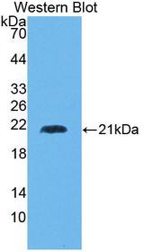 HMMR / CD168 / RHAMM Antibody - Western blot of HMMR / CD168 / RHAMM antibody.